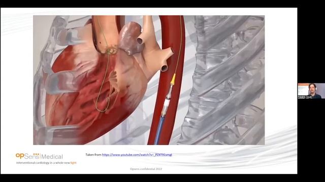 Engineering decisions for cardiovascular interventions with GE Healthcare and OpSens смотреть онлайн