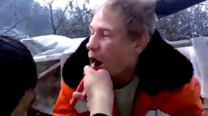 Мужик вырвал зуб плоскогубцами