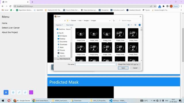 AE084 | Liver Cancer Detection Using UNET смотреть онлайн