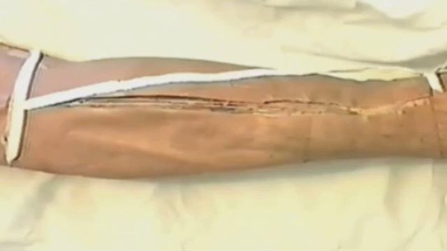 ОБЛАСТЬ ГОЛЕНИ - ДВГМУ