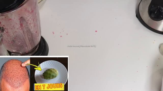 Mettez-le pour vos cheveux et calvitie :ça remplira les trous vides, vous récupérerez vos cheveux! смотреть онлайн