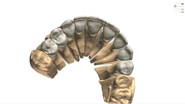 CAD Design Samples by Heather Choi of Rainier Dental Design смотреть онлайн