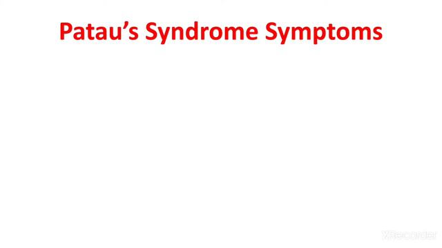 Patau Syndrome || Trisomy 13 || Bartholin-Patau syndrome ||Causes , Diagnosis , Treatment смотреть онлайн