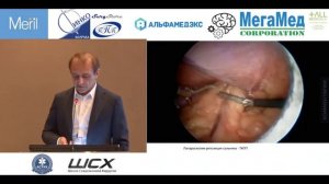 Ущемленная грыжа