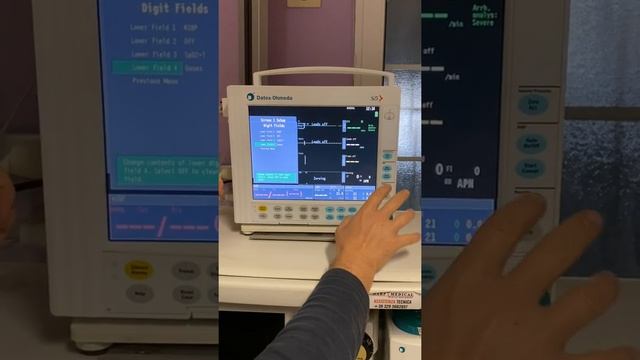 Come si imposta il monitor di anestesia Datex Ohmeda S/5 compact смотреть онлайн