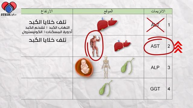 ماذا يعني ارتفاع إنزيمات الكبد | تحليل فحص صحة الكبد LFT