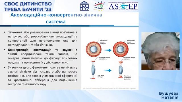 “Діагностика і лікування порушень акомодації і міопії” смотреть онлайн