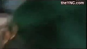 Классическая аденотомия под местной анестезией 1.mp4