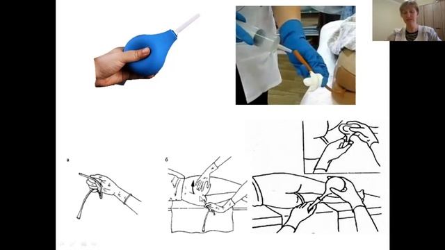 Практическое занятие "Клизмы. Газоотводная трубка." смотреть онлайн