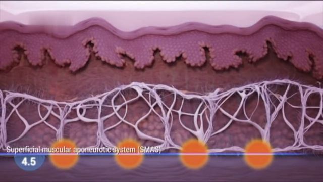 Face lifting and skin tightening hifu Treatment Principle смотреть онлайн
