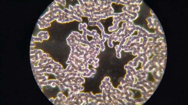 Как избавиться от бактерий в крови. В поисках метода смотреть онлайн