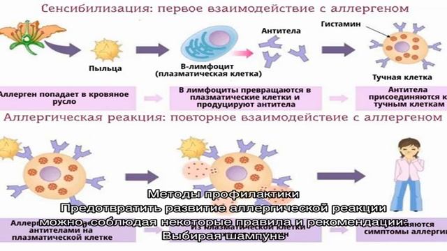 Что делать, если от шампуня чешется голова смотреть онлайн