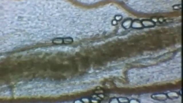 Микрогемоциркуляция (норма и патология) смотреть онлайн