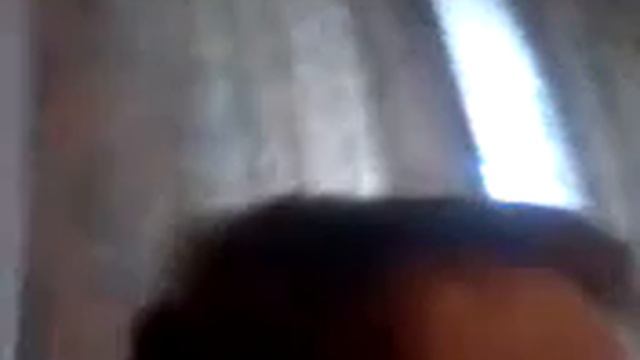 Сильный ушиб ноги смотреть онлайн