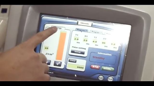 Sincoheren SMQ-NK IPL Operation video смотреть онлайн