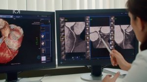 КТ Коронарография