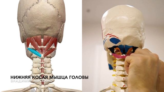 Глубокие мышцы шеи и спины. Как выглядят подзатылочные мышцы шеи и спины? Анатомия 3D смотреть онлайн