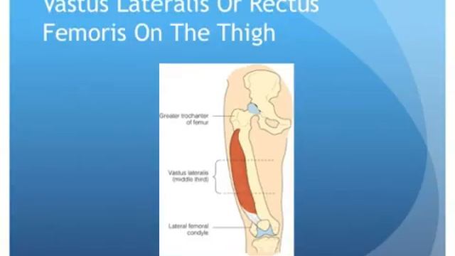 Места внутримышечной инъекции смотреть онлайн