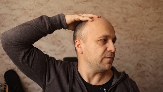 Выполняя это упражнение для шеи каждый день уберете зажимы и растянете шею смотреть онлайн