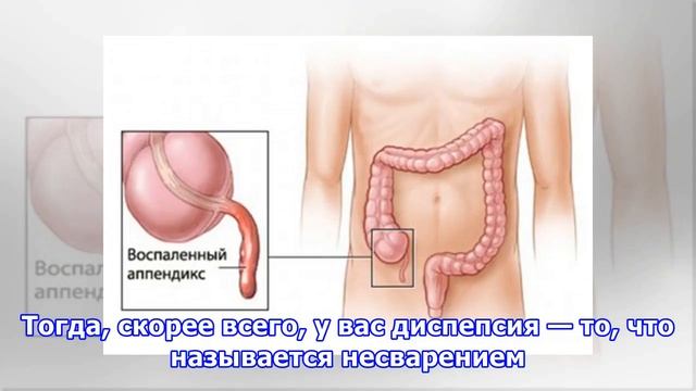 Что делать, если болит живот смотреть онлайн