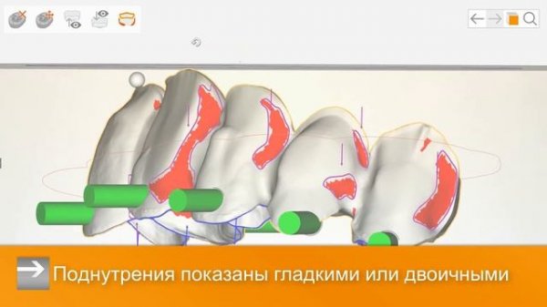 hyperDENT V9.1- RU - Инновации как путь к свободе