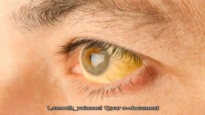 Как лечить повышенный билирубин