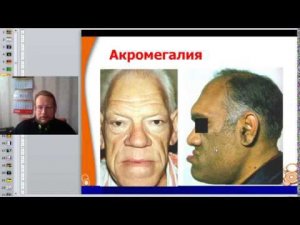 Патофизиология нейроэндокринной системы - надпочечники и щитовидка