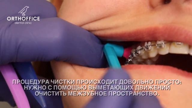 ГИГИЕНА С БРЕКЕТАМИ / МОНОПУЧКОВАЯ ЩЕТКА смотреть онлайн