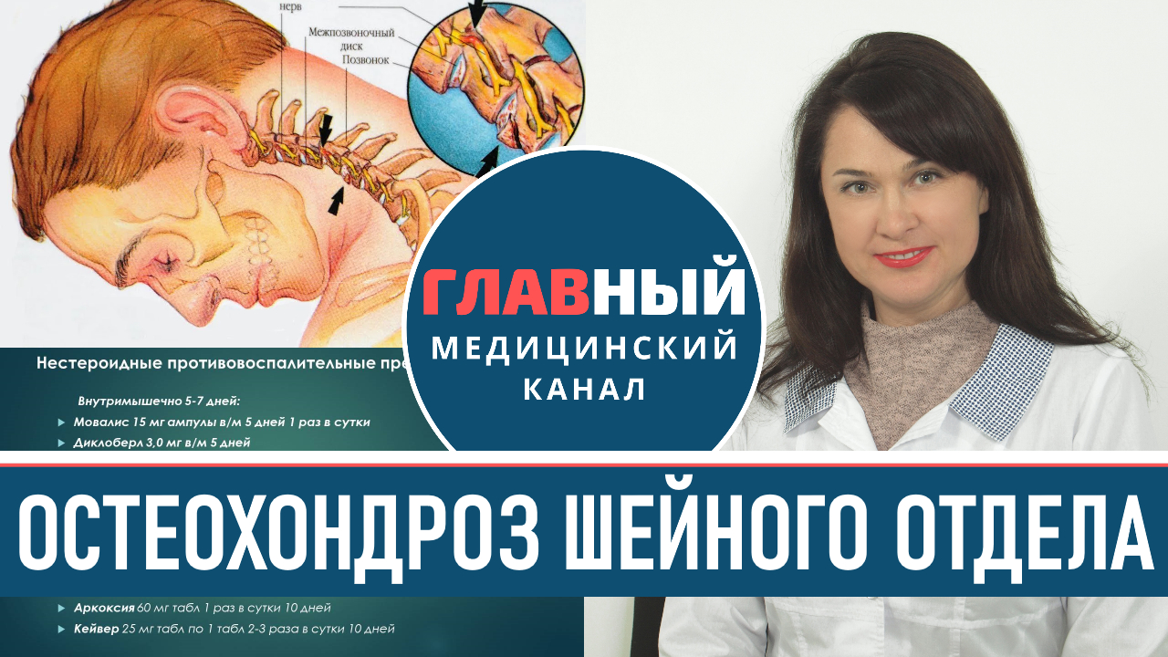 Остеохондроз шейного отдела: симптомы и лечение. Как лечить шейный остеохондроз в домашних условиях смотреть онлайн