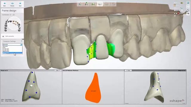 3Shape Dental System - Bridge Framework Design смотреть онлайн