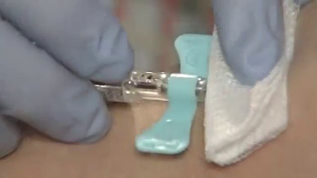 Becton Dickinson Company Video смотреть онлайн