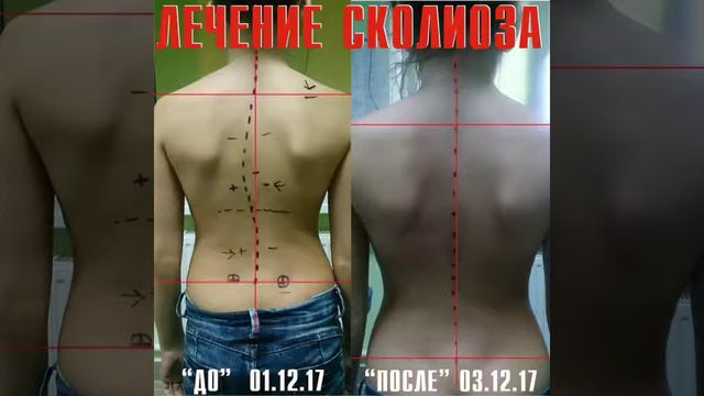 Мануальный терапевт доктор Берн. смотреть онлайн