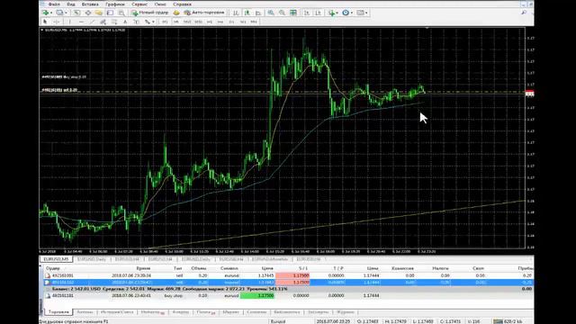 Stop Loss, как правильно ставить стоп лосс смотреть онлайн