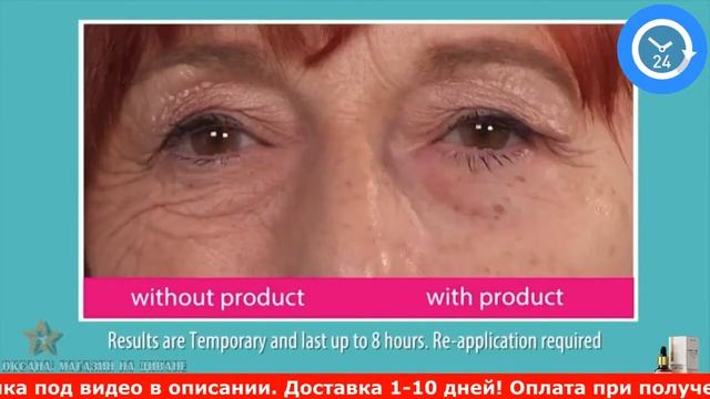 Molecula AntiAge   гиалуроновый заполнитель морщин вокруг глаз