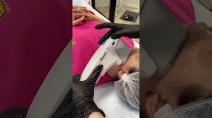 процедура смас лифтинг