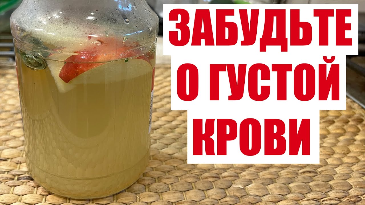 ПЬЮ И ОЖИВАЮ! РАСТВОРЯЕТ БЛЯШКИ, СНИЖАЕТ ДАВЛЕНИЕ, ГУСТУЮ КРОВЬ ДЕЛАЕТ ЖИДКОЙ смотреть онлайн