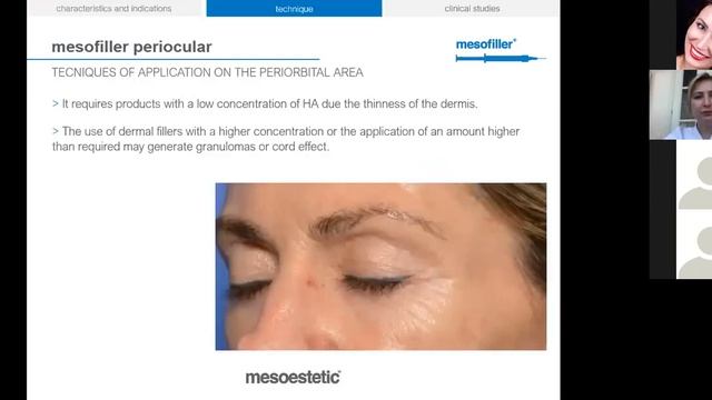 Филлеры MESOESTETIC (Испания) Mesofiller. смотреть онлайн