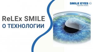 ReLEx SMILE (СМАЙЛ) - лазерная коррекция зрения, на смену ФРК и ЛАСИК