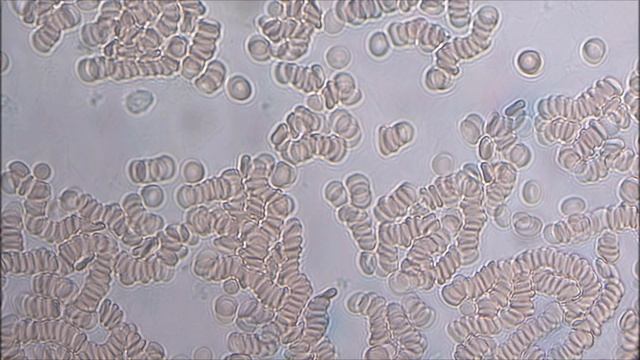 6 часов после приёма раствора Метиленовый синий смотреть онлайн
