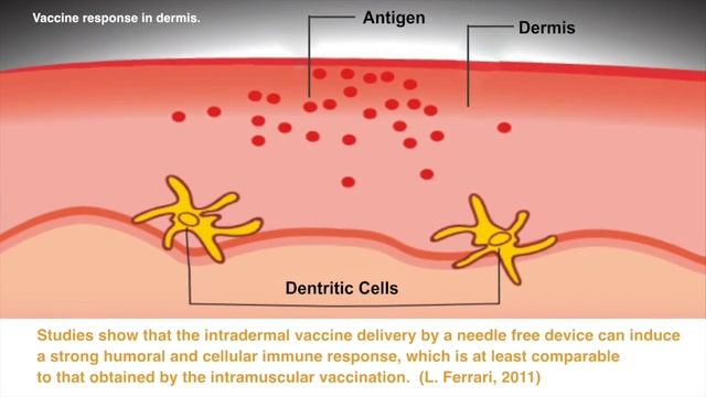 The IDAL 3G Twin смотреть онлайн