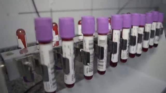 Apresentação Aparelhos HC Laboratório смотреть онлайн