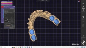 ExoCad модель со штампиками