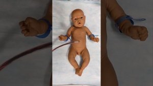 Реанимация новорожденных с асфиксией