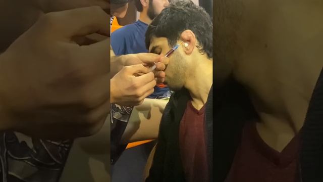 Борец сломал ухо на тренировке. Кровь из ушей. Rizvan MMA смотреть онлайн