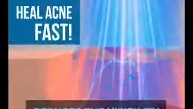 Акне лазерная ручка портативная машина для удаления морщин прочный мягкий крем шрамов устройство смотреть онлайн