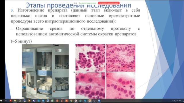 Экспресс-биопсия в патологической анатомии смотреть онлайн