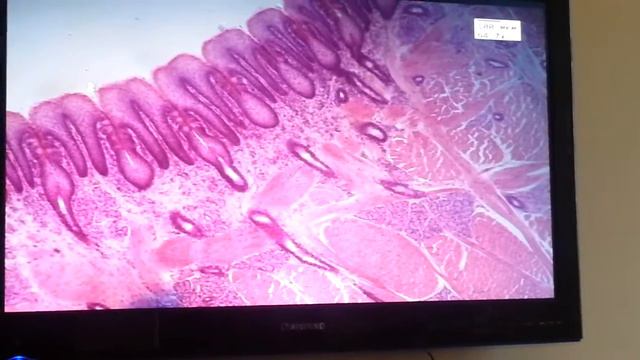 Гистология Листовидные сосочки языка [Пищеварительная система] смотреть онлайн