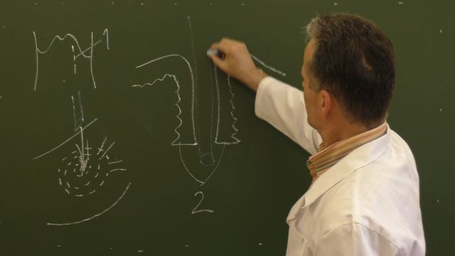 Схема желудочного свища по Штамму-Сенну-Кадеру смотреть онлайн