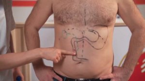 Как убрать ГАЗЫ В КИШЕЧНИКЕ  9 причин вздутия живота