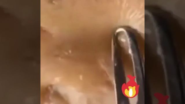 Давим жирные угри. Релаксация для глаз. смотреть онлайн